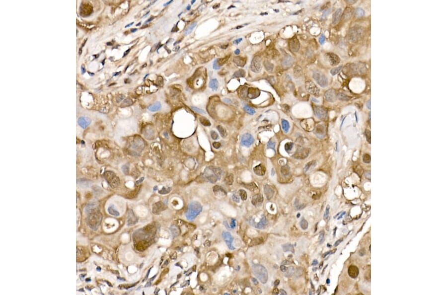 Immunohistochemistry - Anti-ATP citrate lyase Antibody (A88052) - Antibodies.com