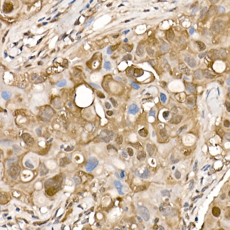 Immunohistochemistry - Anti-ATP citrate lyase Antibody (A88052) - Antibodies.com