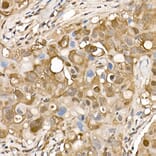 Immunohistochemistry - Anti-ATP citrate lyase Antibody (A88052) - Antibodies.com