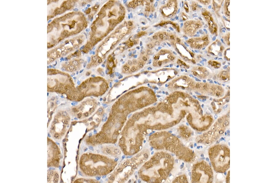 Immunohistochemistry - Anti-ATP citrate lyase Antibody (A88052) - Antibodies.com