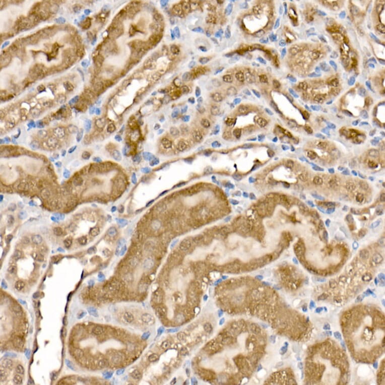 Immunohistochemistry - Anti-ATP citrate lyase Antibody (A88052) - Antibodies.com