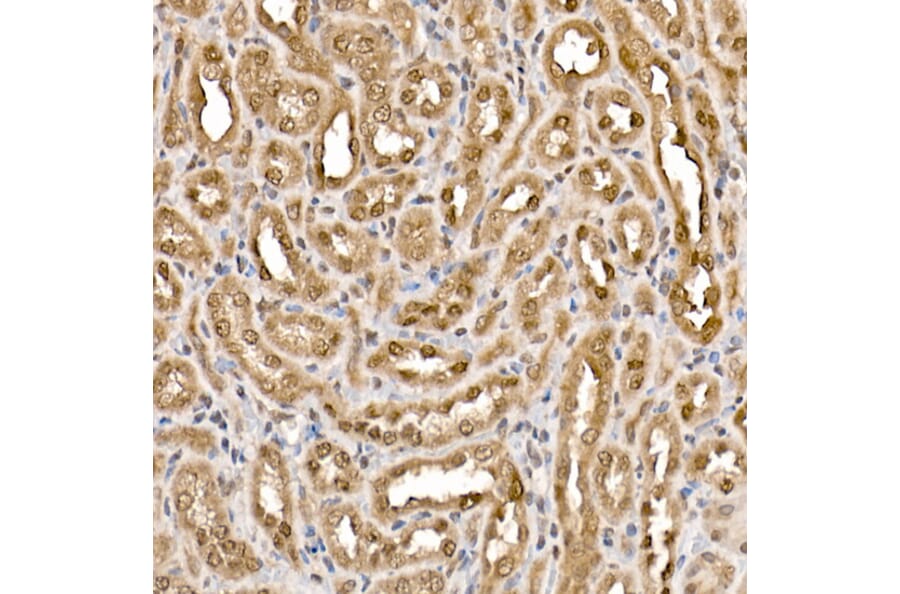Immunohistochemistry - Anti-ATP citrate lyase Antibody (A88052) - Antibodies.com