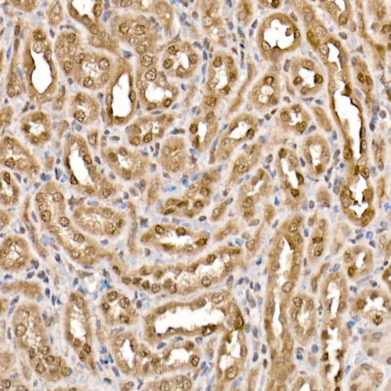 Immunohistochemistry - Anti-ATP citrate lyase Antibody (A88052) - Antibodies.com