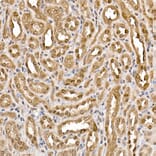 Immunohistochemistry - Anti-ATP citrate lyase Antibody (A88052) - Antibodies.com