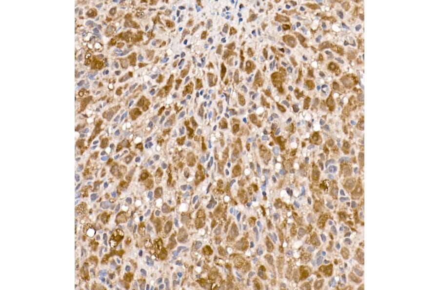 Immunohistochemistry - Anti-ATP citrate lyase Antibody (A88052) - Antibodies.com
