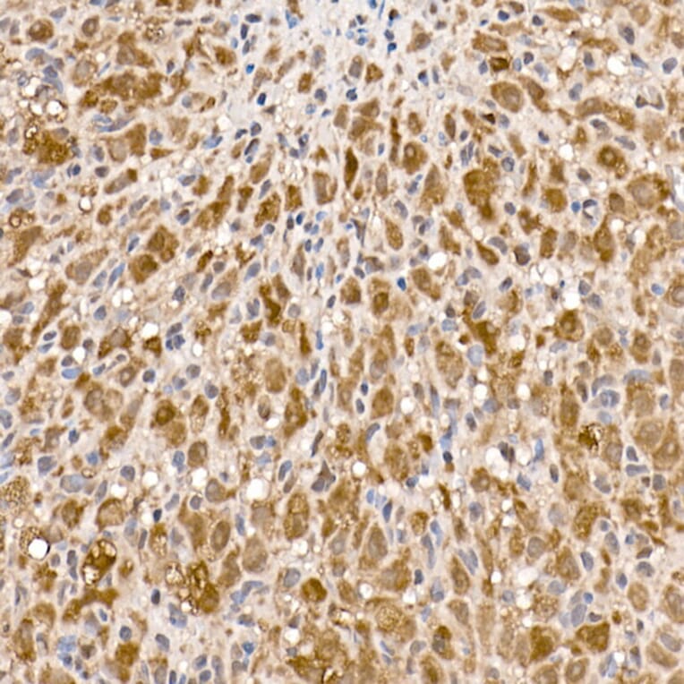 Immunohistochemistry - Anti-ATP citrate lyase Antibody (A88052) - Antibodies.com