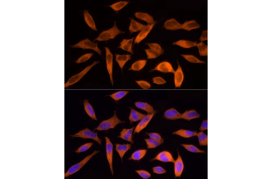 Immunofluorescence - Anti-ATP citrate lyase Antibody (A88052) - Antibodies.com