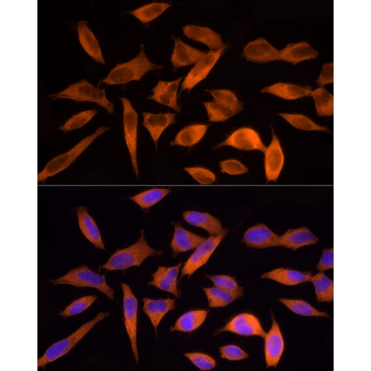 Immunofluorescence - Anti-ATP citrate lyase Antibody (A88052) - Antibodies.com