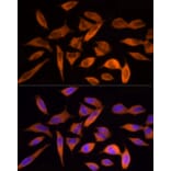 Immunofluorescence - Anti-ATP citrate lyase Antibody (A88052) - Antibodies.com