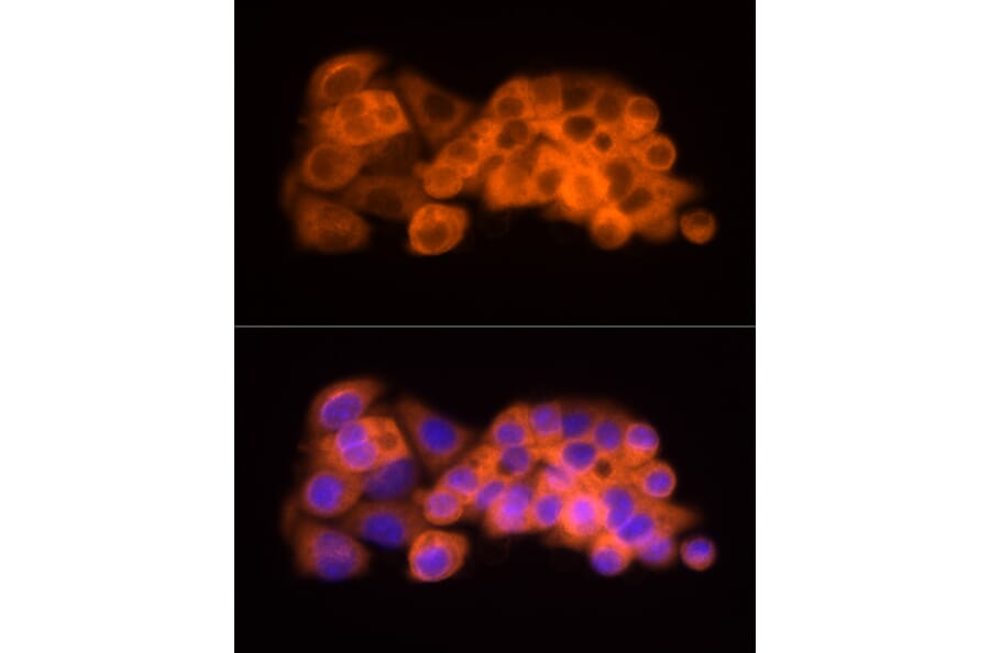 Immunofluorescence - Anti-ATP citrate lyase Antibody (A88052) - Antibodies.com