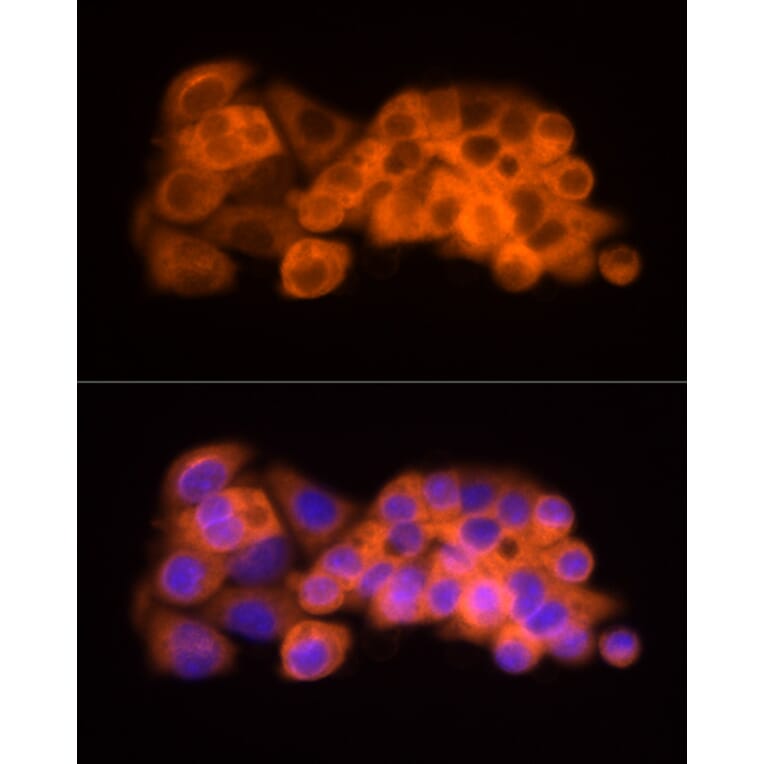 Immunofluorescence - Anti-ATP citrate lyase Antibody (A88052) - Antibodies.com