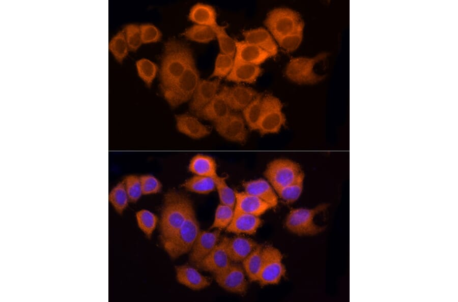 Immunofluorescence - Anti-ATP citrate lyase Antibody (A88052) - Antibodies.com