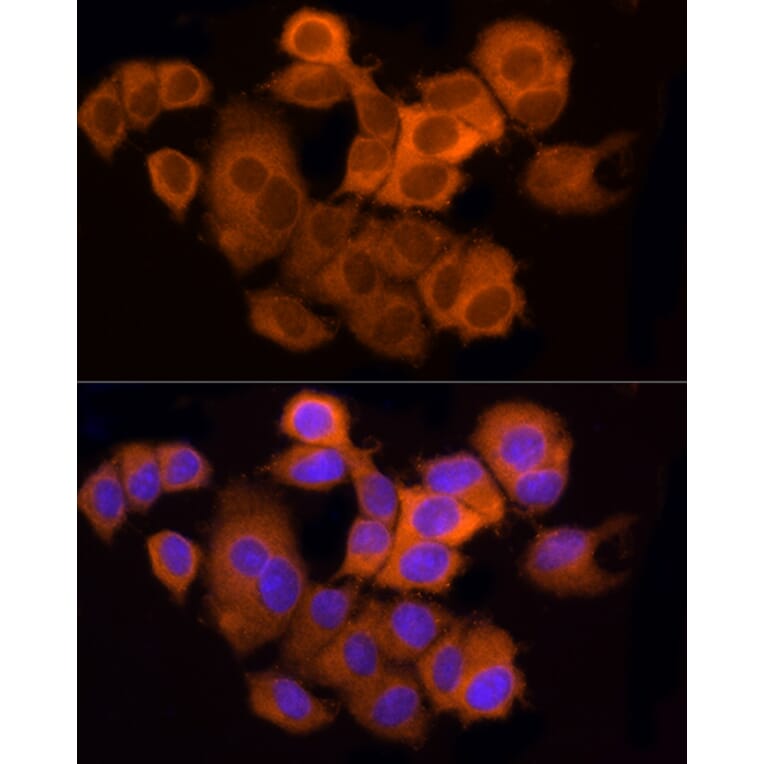 Immunofluorescence - Anti-ATP citrate lyase Antibody (A88052) - Antibodies.com