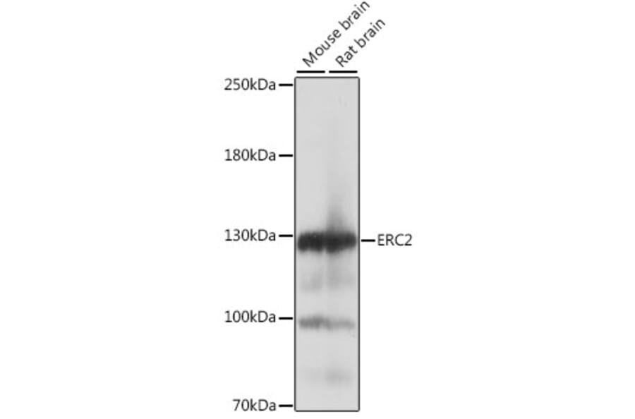 Western Blot - Anti-ERC2 Antibody (A88053) - Antibodies.com