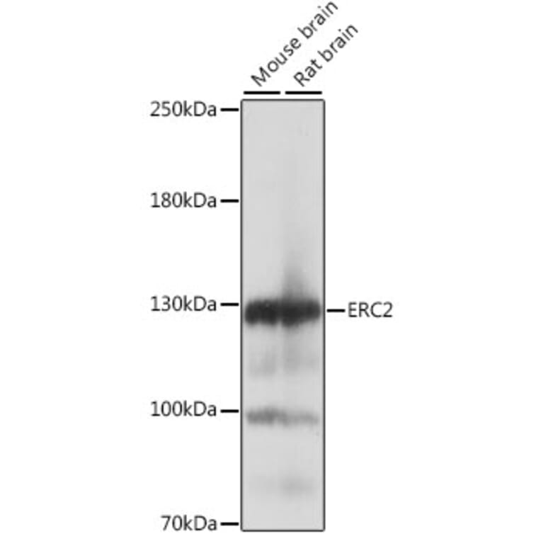 Western Blot - Anti-ERC2 Antibody (A88053) - Antibodies.com