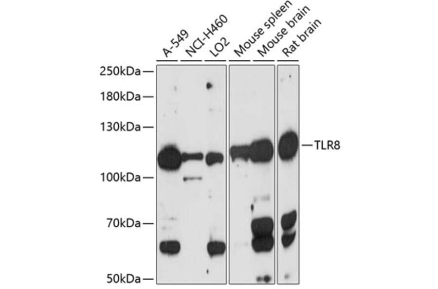 Western Blot - Anti-TLR8 Antibody (A88054) - Antibodies.com