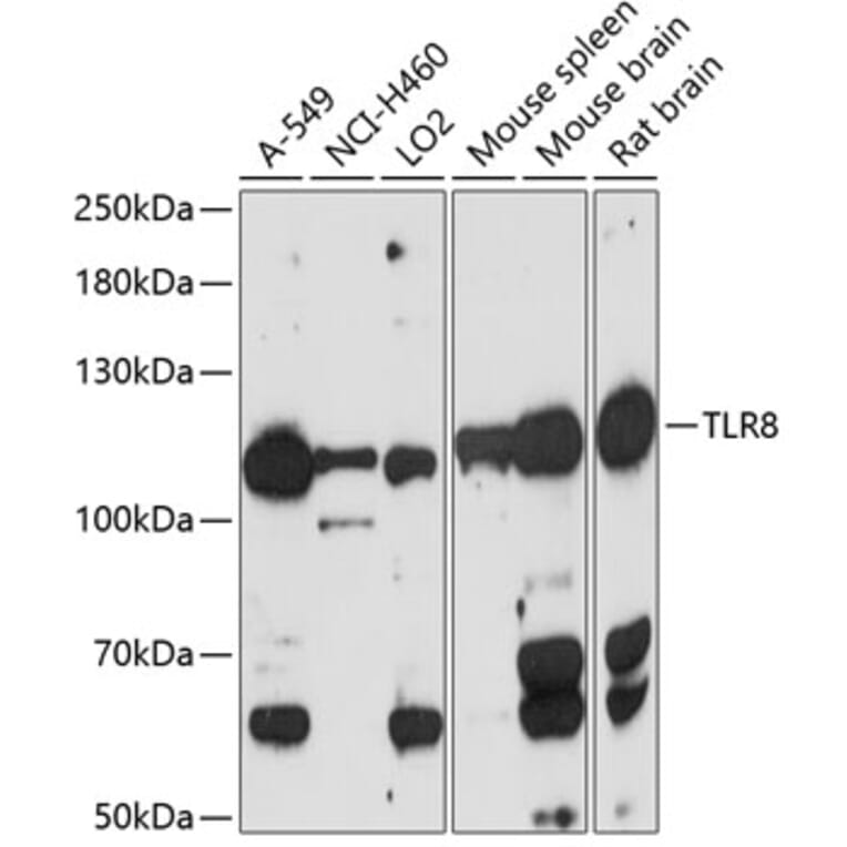 Western Blot - Anti-TLR8 Antibody (A88054) - Antibodies.com