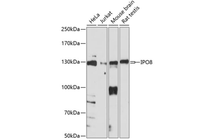 Western Blot - Anti-Importin 8 Antibody (A88056) - Antibodies.com