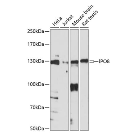 Western Blot - Anti-Importin 8 Antibody (A88056) - Antibodies.com