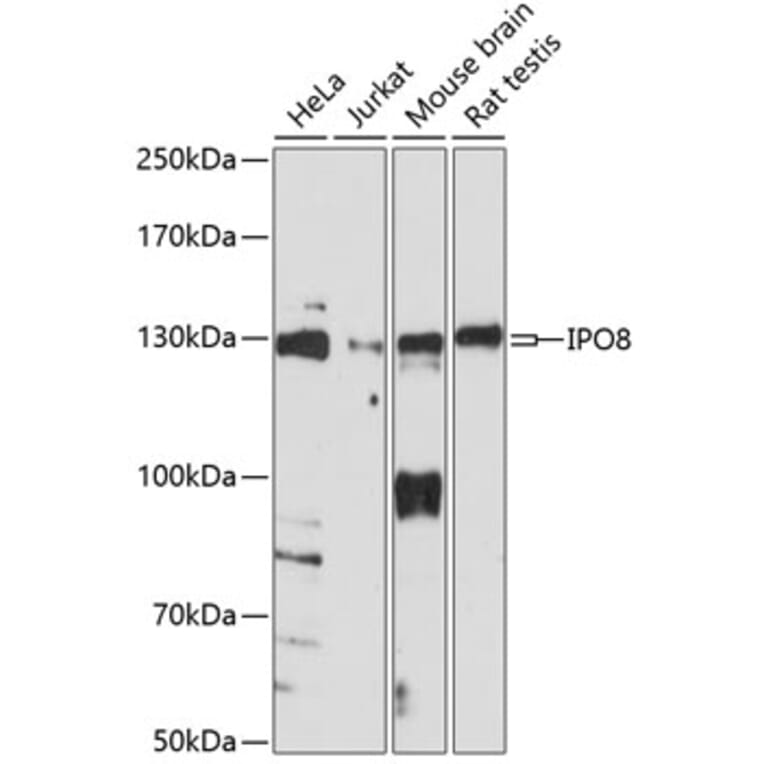 Western Blot - Anti-Importin 8 Antibody (A88056) - Antibodies.com