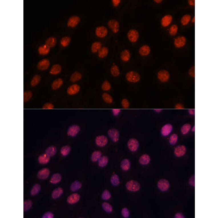 Immunofluorescence - Anti-Importin 8 Antibody (A88056) - Antibodies.com