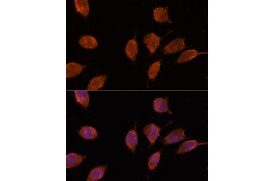 Immunofluorescence - Anti-Importin 8 Antibody (A88056) - Antibodies.com