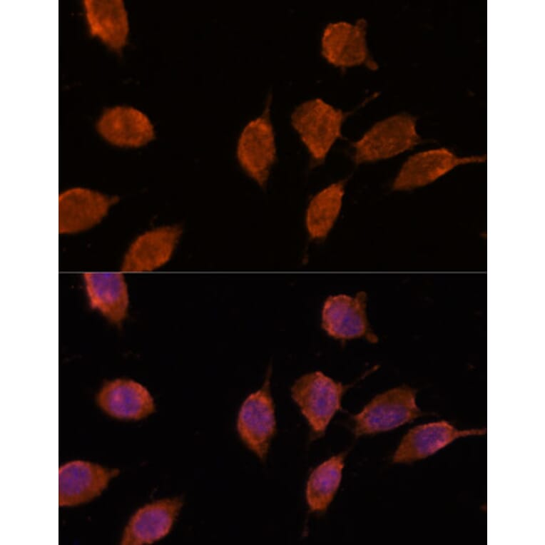 Immunofluorescence - Anti-Importin 8 Antibody (A88056) - Antibodies.com