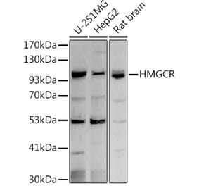 Western Blot - Anti-HMGCR Antibody (A88058) - Antibodies.com