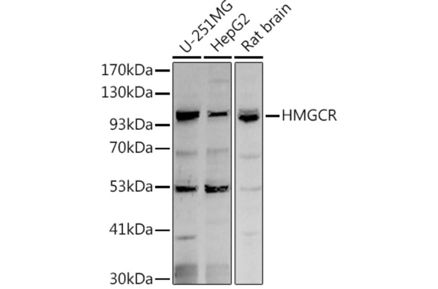 Western Blot - Anti-HMGCR Antibody (A88058) - Antibodies.com