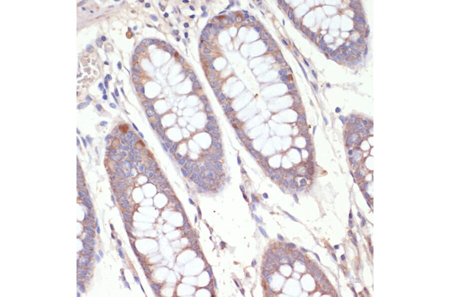 Immunohistochemistry - Anti-HMGCR Antibody (A88058) - Antibodies.com