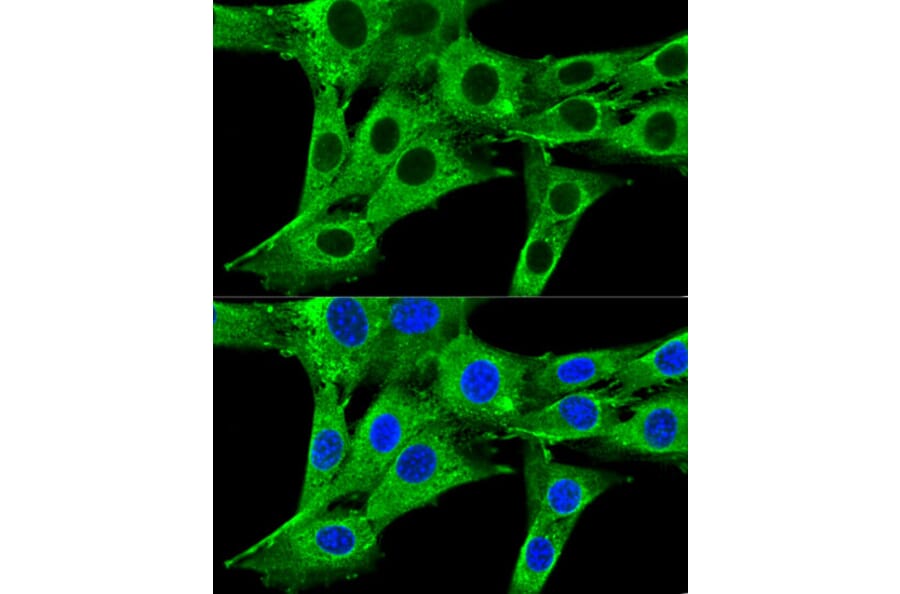 Immunofluorescence - Anti-HMGCR Antibody (A88058) - Antibodies.com