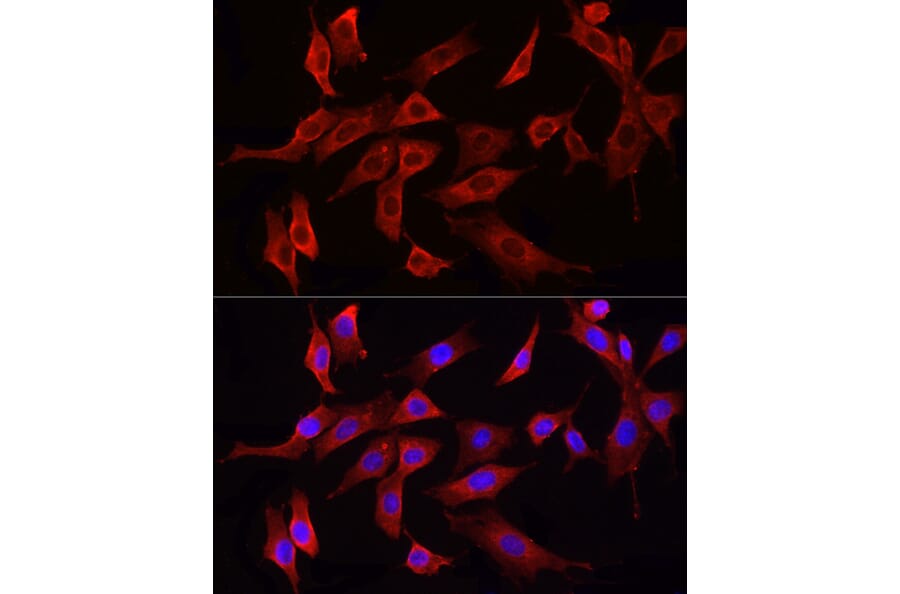 Immunofluorescence - Anti-HMGCR Antibody (A88058) - Antibodies.com