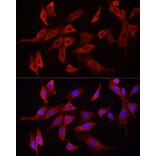 Immunofluorescence - Anti-HMGCR Antibody (A88058) - Antibodies.com