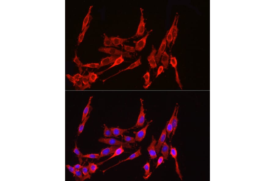 Immunofluorescence - Anti-HMGCR Antibody (A88058) - Antibodies.com