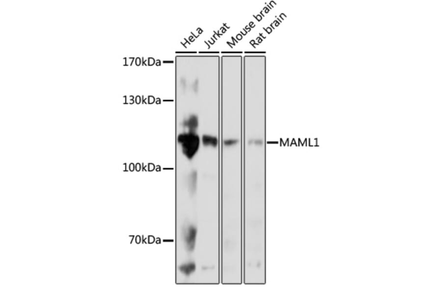 Western Blot - Anti-MAML1 Antibody (A88059) - Antibodies.com