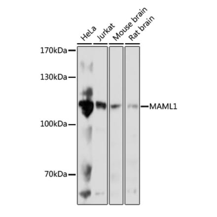 Western Blot - Anti-MAML1 Antibody (A88059) - Antibodies.com