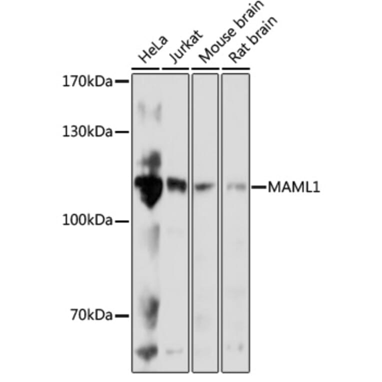 Western Blot - Anti-MAML1 Antibody (A88059) - Antibodies.com