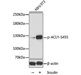 Western Blot - Anti-ATP citrate lyase (phospho Ser455) Antibody (A88061) - Antibodies.com