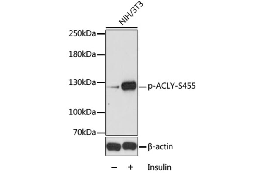 Western Blot - Anti-ATP citrate lyase (phospho Ser455) Antibody (A88061) - Antibodies.com