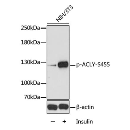 Western Blot - Anti-ATP citrate lyase (phospho Ser455) Antibody (A88061) - Antibodies.com