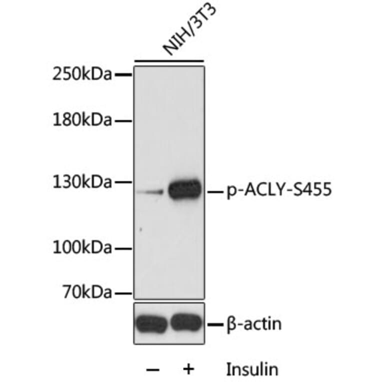 Western Blot - Anti-ATP citrate lyase (phospho Ser455) Antibody (A88061) - Antibodies.com