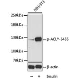 Western Blot - Anti-ATP citrate lyase (phospho Ser455) Antibody (A88061) - Antibodies.com