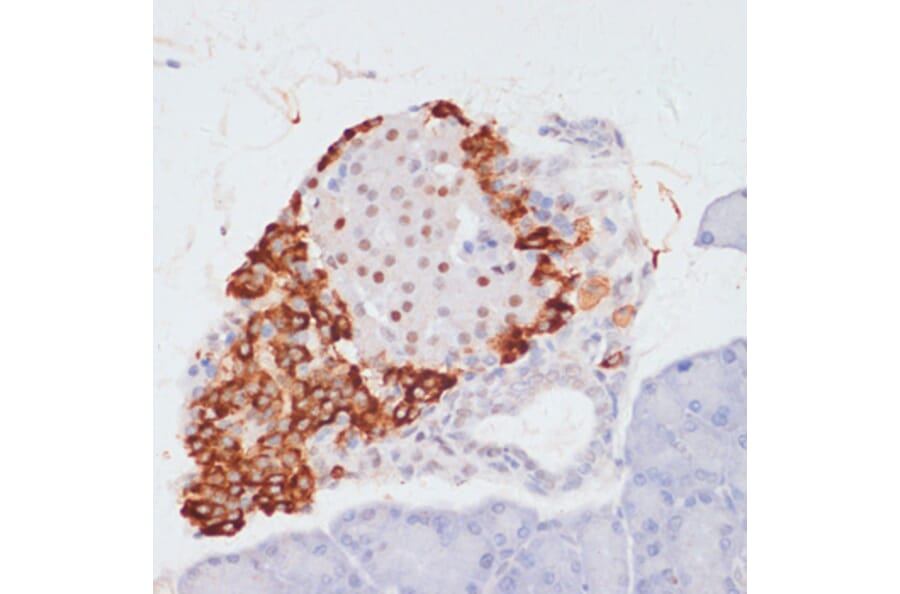 Immunohistochemistry - Anti-ATP citrate lyase (phospho Ser455) Antibody (A88061) - Antibodies.com