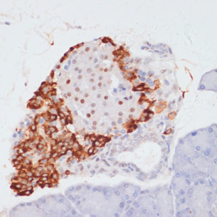 Immunohistochemistry - Anti-ATP citrate lyase (phospho Ser455) Antibody (A88061) - Antibodies.com