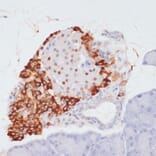 Immunohistochemistry - Anti-ATP citrate lyase (phospho Ser455) Antibody (A88061) - Antibodies.com