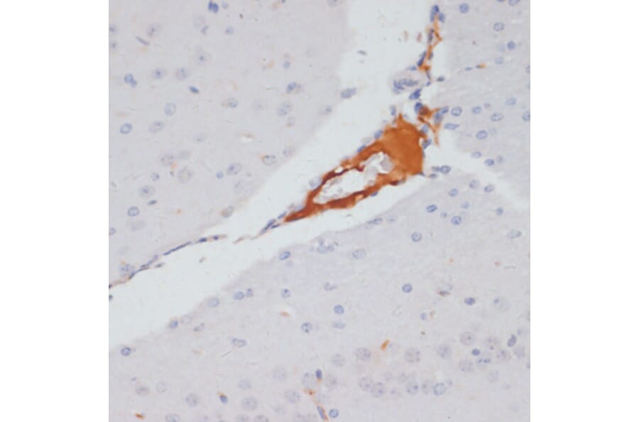 Immunohistochemistry - Anti-ATP citrate lyase (phospho Ser455) Antibody (A88061) - Antibodies.com