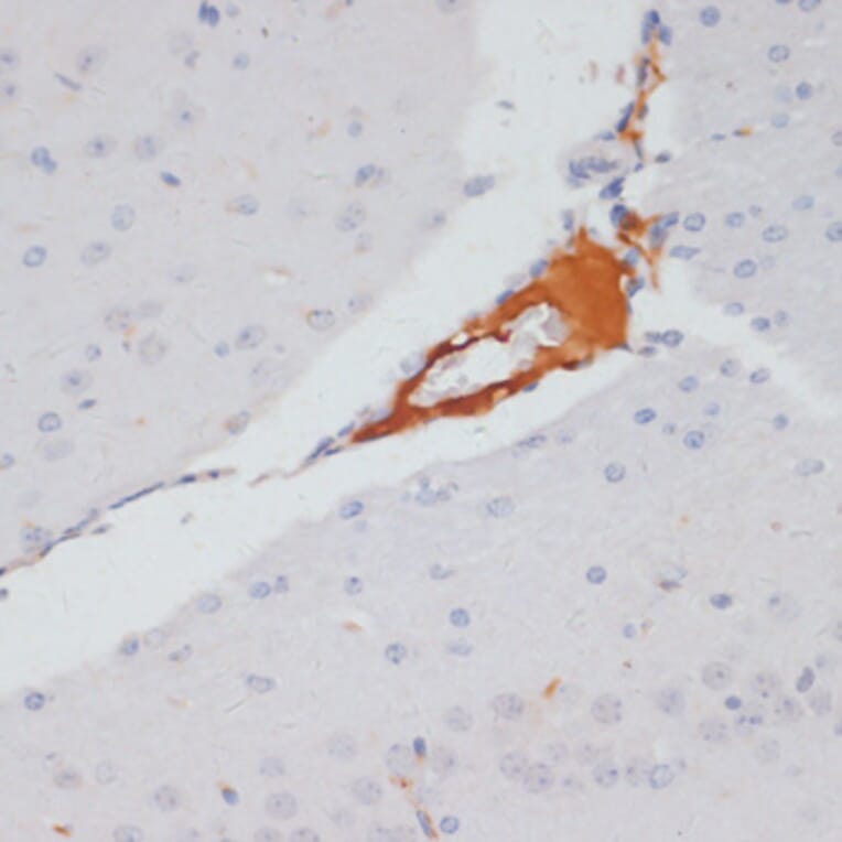 Immunohistochemistry - Anti-ATP citrate lyase (phospho Ser455) Antibody (A88061) - Antibodies.com