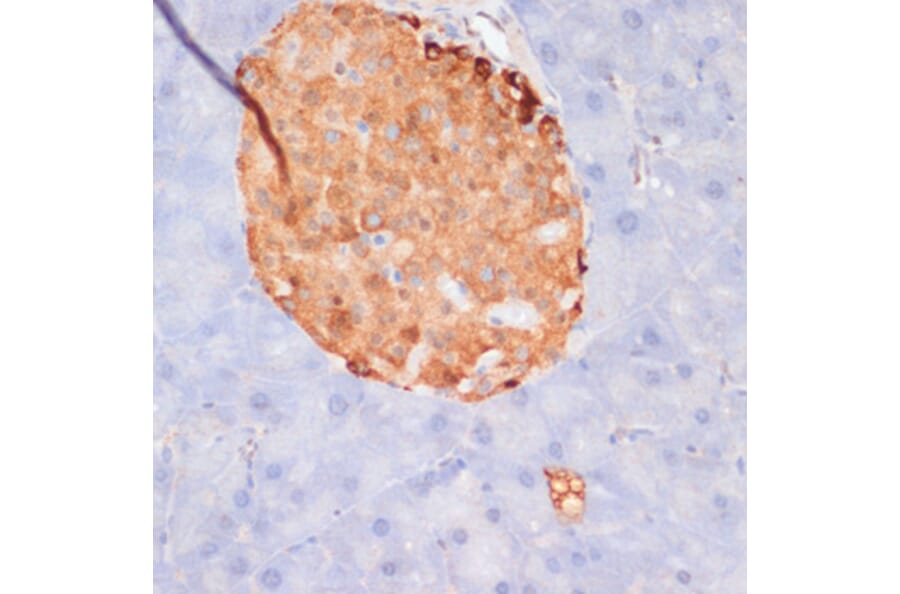 Immunohistochemistry - Anti-ATP citrate lyase (phospho Ser455) Antibody (A88061) - Antibodies.com