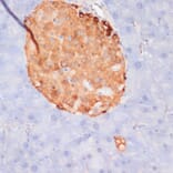 Immunohistochemistry - Anti-ATP citrate lyase (phospho Ser455) Antibody (A88061) - Antibodies.com