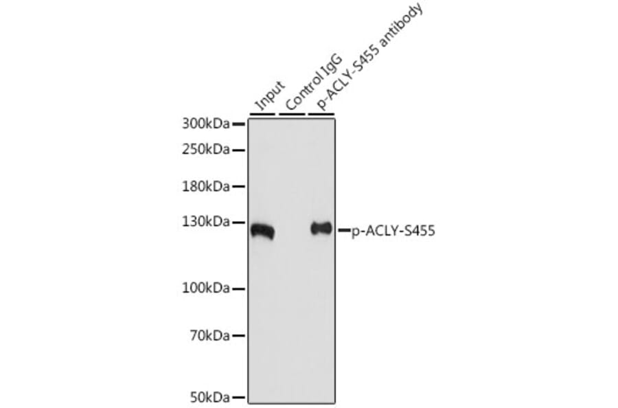 Western Blot - Anti-ATP citrate lyase (phospho Ser455) Antibody (A88061) - Antibodies.com
